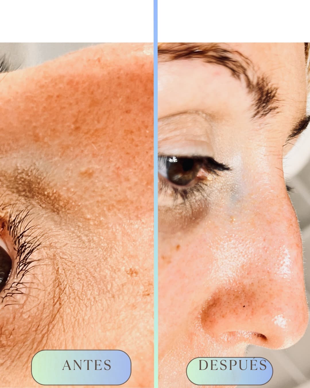 Wimpernverlängerung